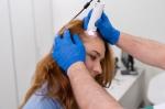 How to Fix Thinning Hair Fast: Expert Hair Loss Treatment for Women